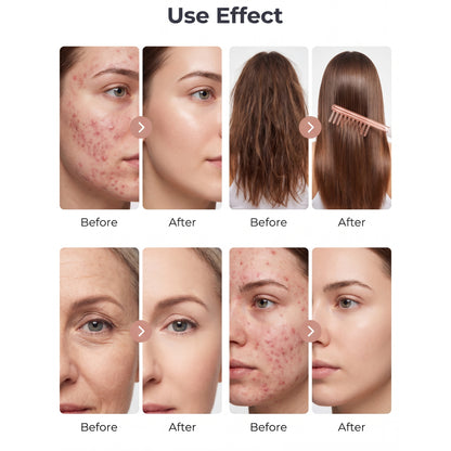 DermaVolt™ Aura Wand